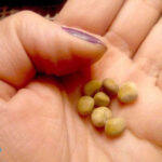 سنگ کلیه